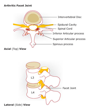 Facet Joint